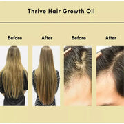 Thrive Hair Growth Essential Oil Hair